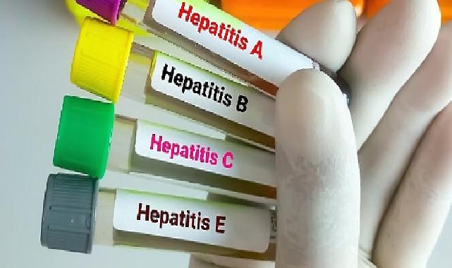 Hepatitte Aşılama Kronik Enfeksiyonları Önlemede %95 Etkili