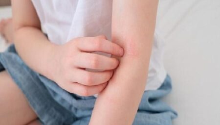 Çocuklarda ‘Alerjik Hastalıklar’ Hakkında Doğru Sanılan 8 Hatalı Bilgi!