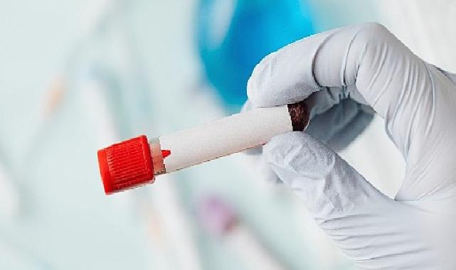 Sepsis: Vücudun Sessiz Fırtınası